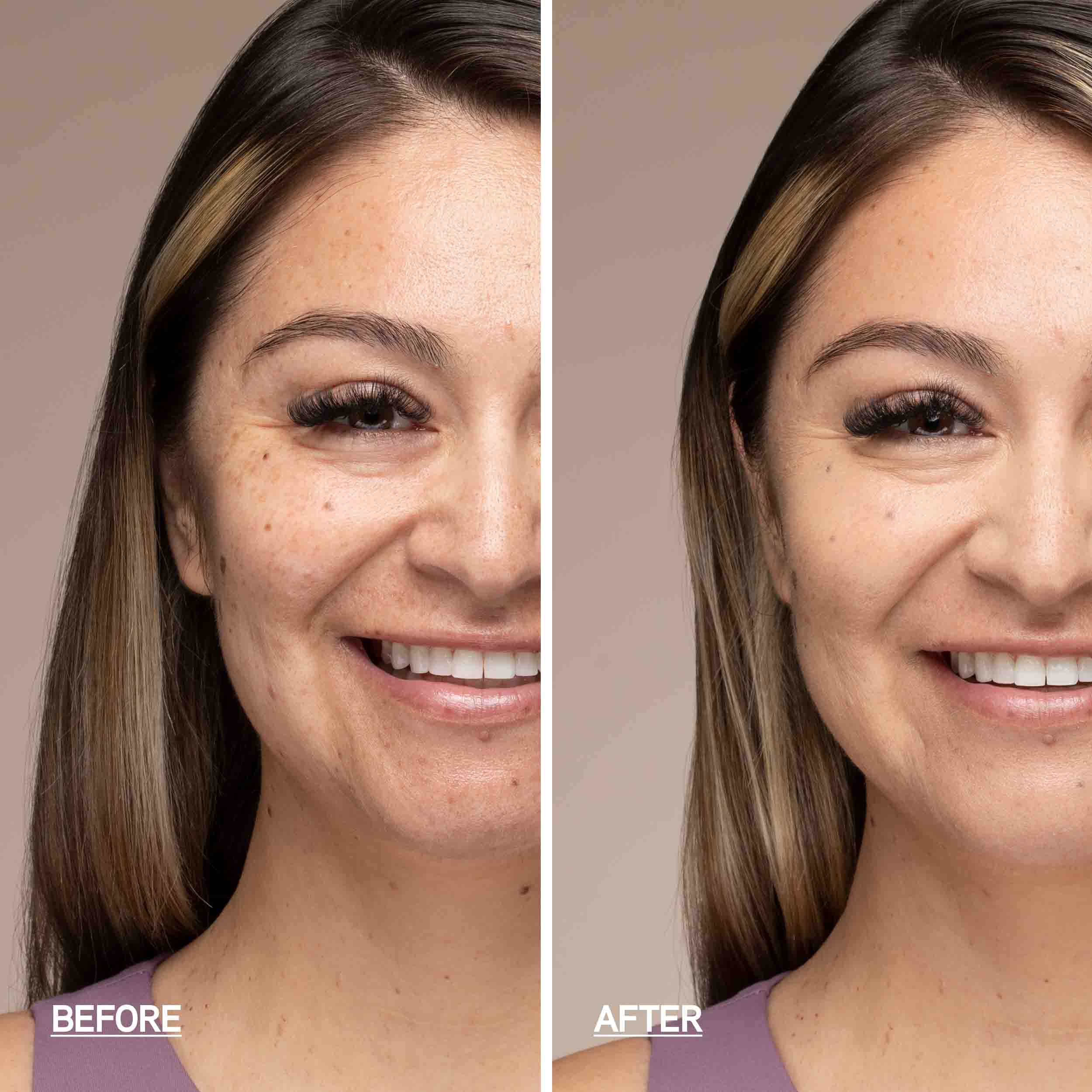 1712794_4_Before-After.jpg